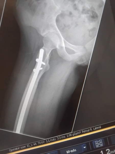 To ask if my daughters xray looks 'normal'?