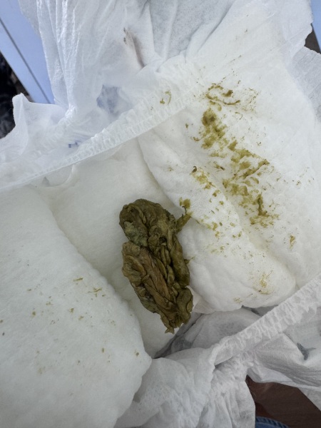 What’s this poop?? *GRAPHIC!