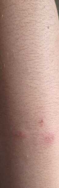 What are these spots / bites?
