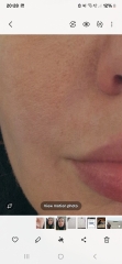 To ask what can be done about this awful skin texture?