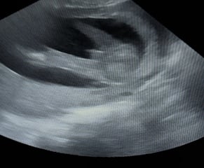 Boy or girl? 17w