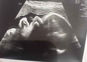 Guessing gender