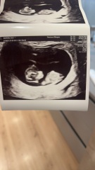 Boy or girl nub 10w