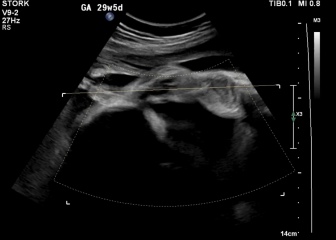 29 week gender confusion? Thoughts?