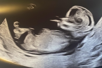 Nub? Is there no nub? Anyone got any guesses