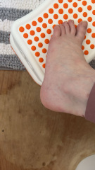 Possible broken bones