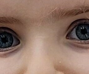 Could this leave a scar?