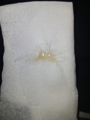 Is this a miscarriage?