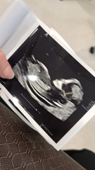 Boy or girl any guesses??