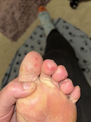 Anyone want to try and diagnose me since doctors can’t?