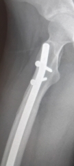 To ask if my daughters xray looks 'normal'?
