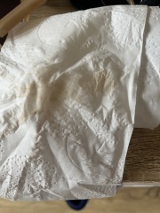 Weird spotting but no period - pregnant or miscarriage?