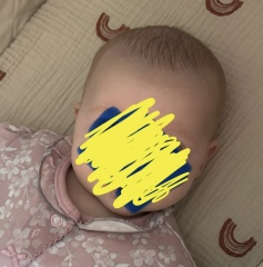 microcephaly? When to worry?