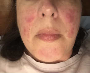 Husbands anxiety is destroying our marriage