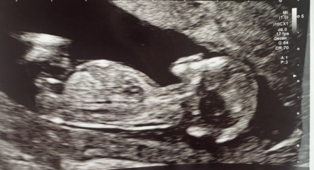 GENDER PREDICTIONS💖💙