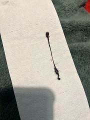 Spotting - brown discharge