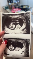 Boy or girl nub 10w