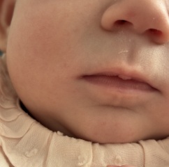 Does this look like a cold sore?