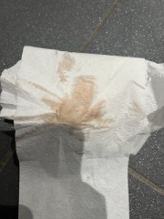 Weird spotting but no period - pregnant or miscarriage?