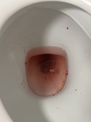 Has anyone had this