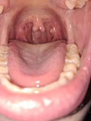 Would you worry about this?