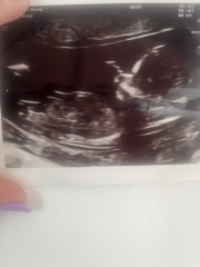 Nub theory ! Boy or girl ?
