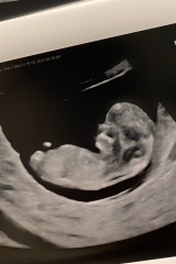 Boy or Girl Guesses
