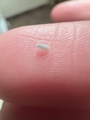 What are these?