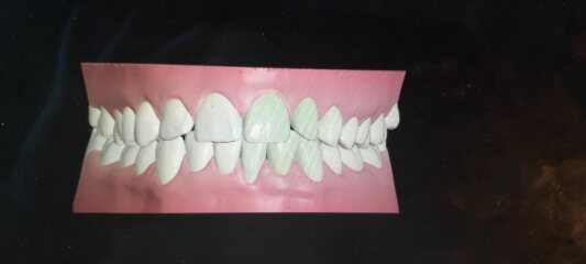 Need opinions : would you be happy with your teeth after this result?