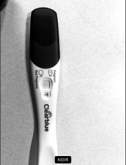 Help - am I pregnant?