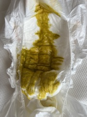 Diarrhea or normal - 5 month old baby