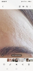 To ask what can be done about this awful skin texture?