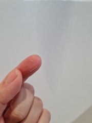 Is this limescale?