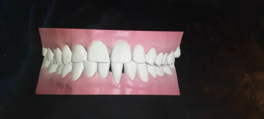 Need opinions : would you be happy with your teeth after this result?