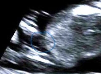 Girl or boy?