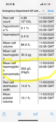 Can anyone help me understand my blood test-iron results