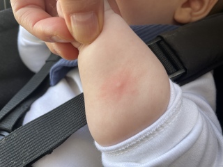 What are these spots?