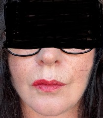 Having facelift surgery in 10 days - support and advice needed