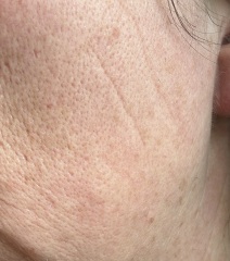 Please help me with this awful skin