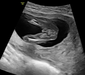 Private Gender Scan Right?