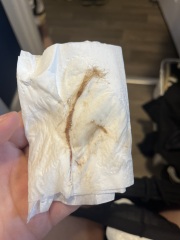 Is this a miscarriage?