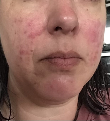 Husbands anxiety is destroying our marriage