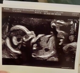 Girl or boy?