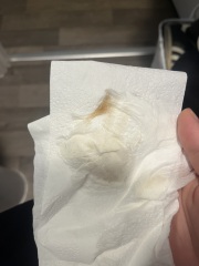 Is this a miscarriage?