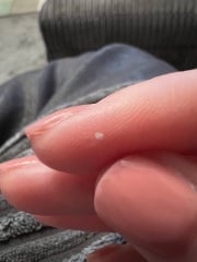 What are these?