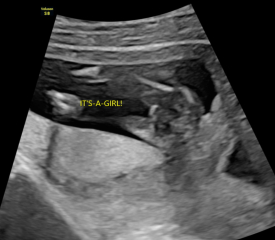 Private Gender Scan Right?