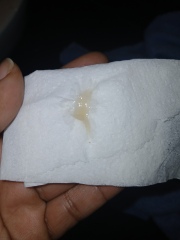 Is this a miscarriage?