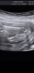 Gender scan