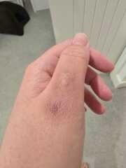 Mystery - Thumb went black
