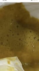 5 week old - diarrhoea frothy poo? Photo warning